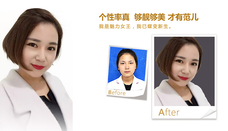 湖州美鼻、V脸