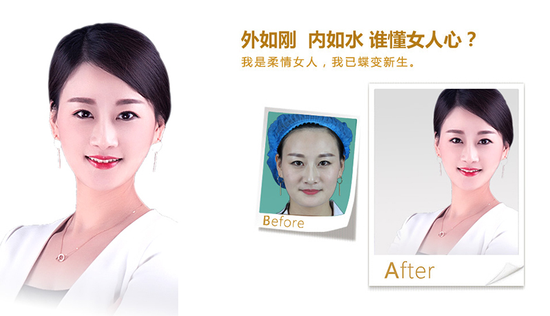 湖州V脸、线雕隆鼻